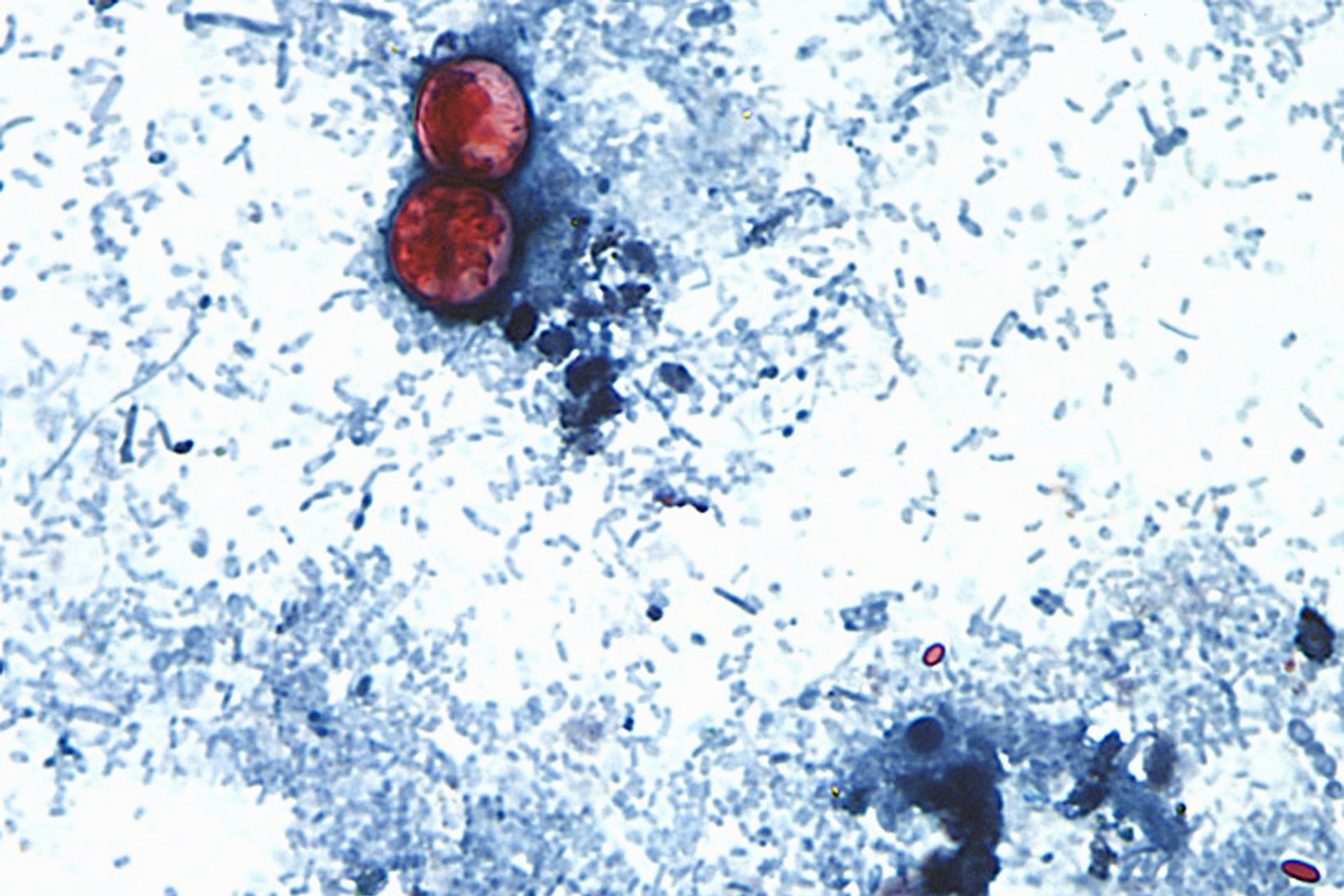Fin del brote de cyclospora en EU; origen sin resolver