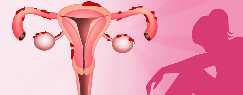 Avalan ley para prevenir y atender endometriosis en Campeche